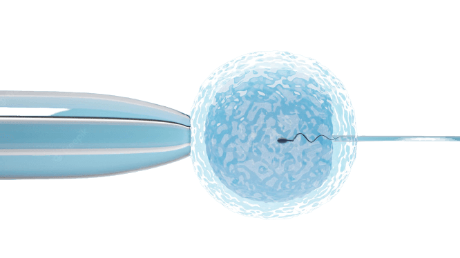 Intracytoplasmic Sperm Injection (ICSI)