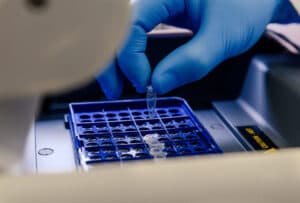 Endometrial Receptive Assay (ERA)